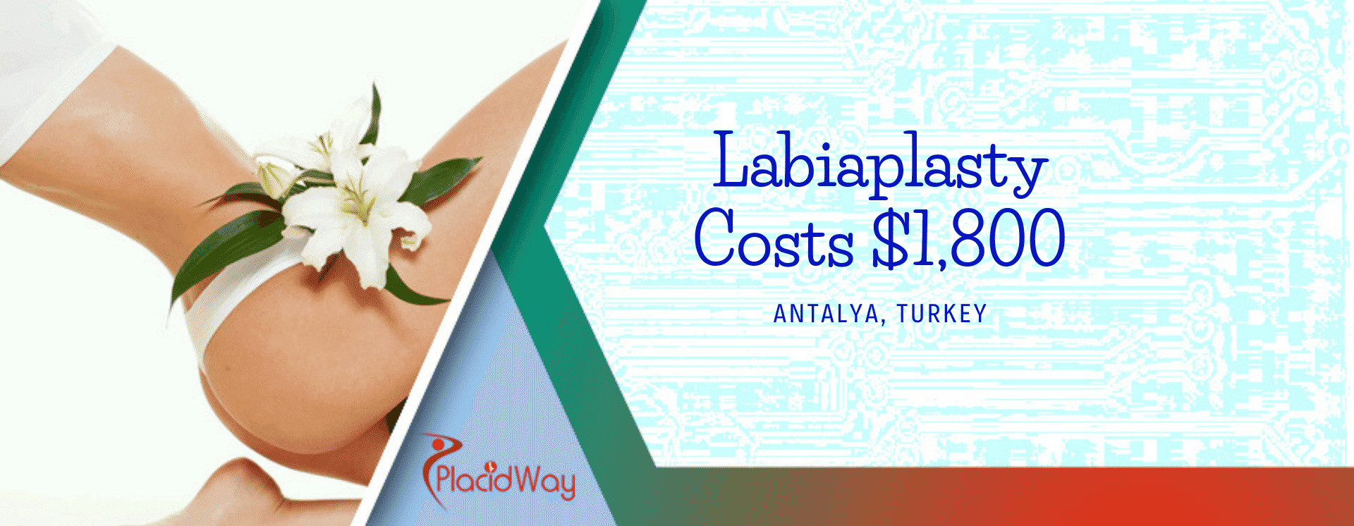 Labiaplasty in Antalya, Turkey